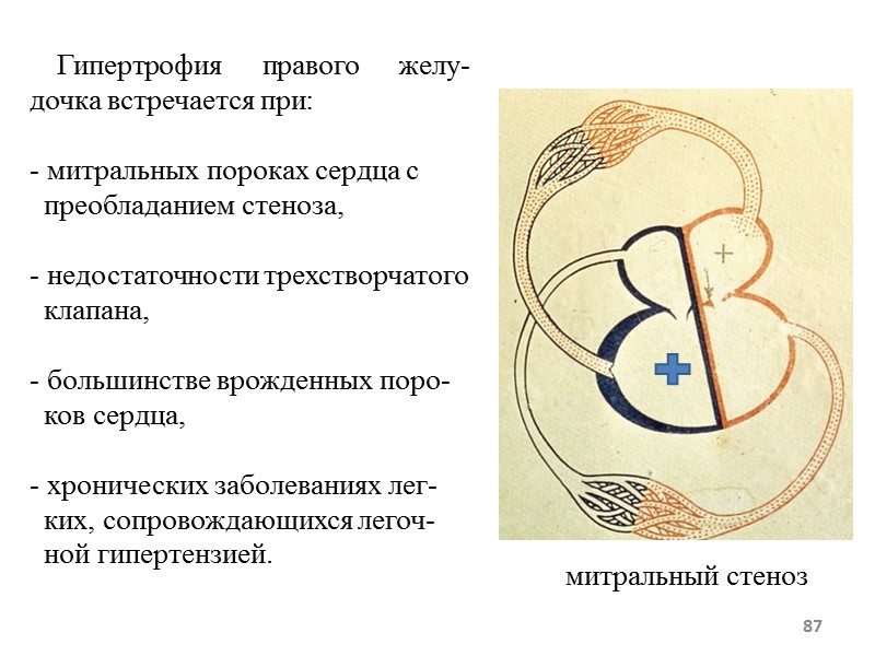 87 Гипертрофия правого желу-дочка встречается при: митральных 87 Гипертрофия правого желу-дочка встречается при: митральных